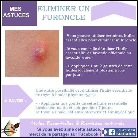 comment soigner un furoncle fessier|Furoncle fessier : symptômes, causes, traitements et prévention